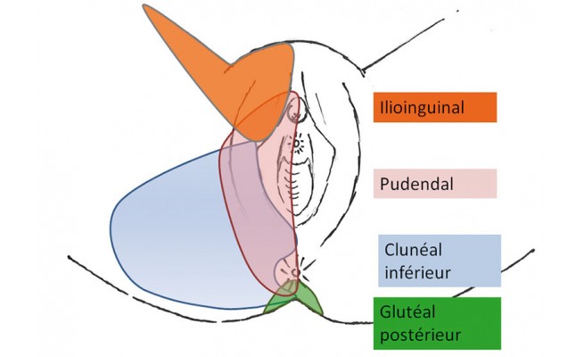 KA1479P20.jpg